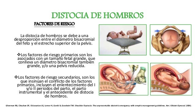 distocias de hombros
